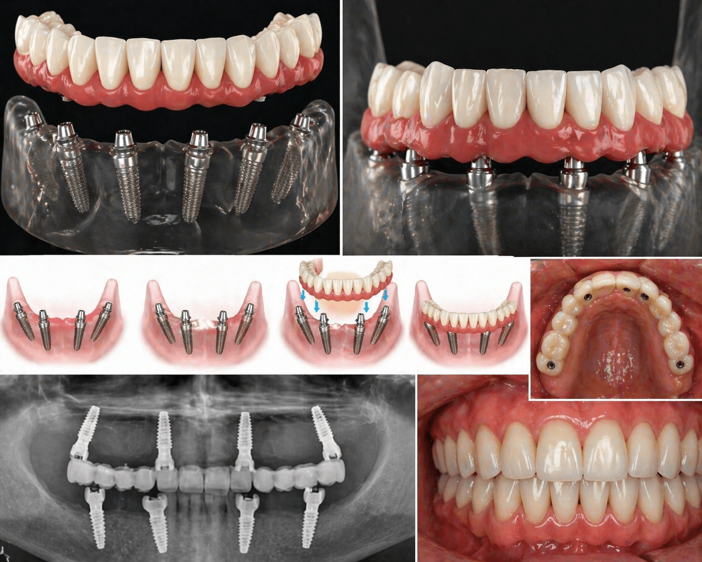 Dental & Smile Restoration