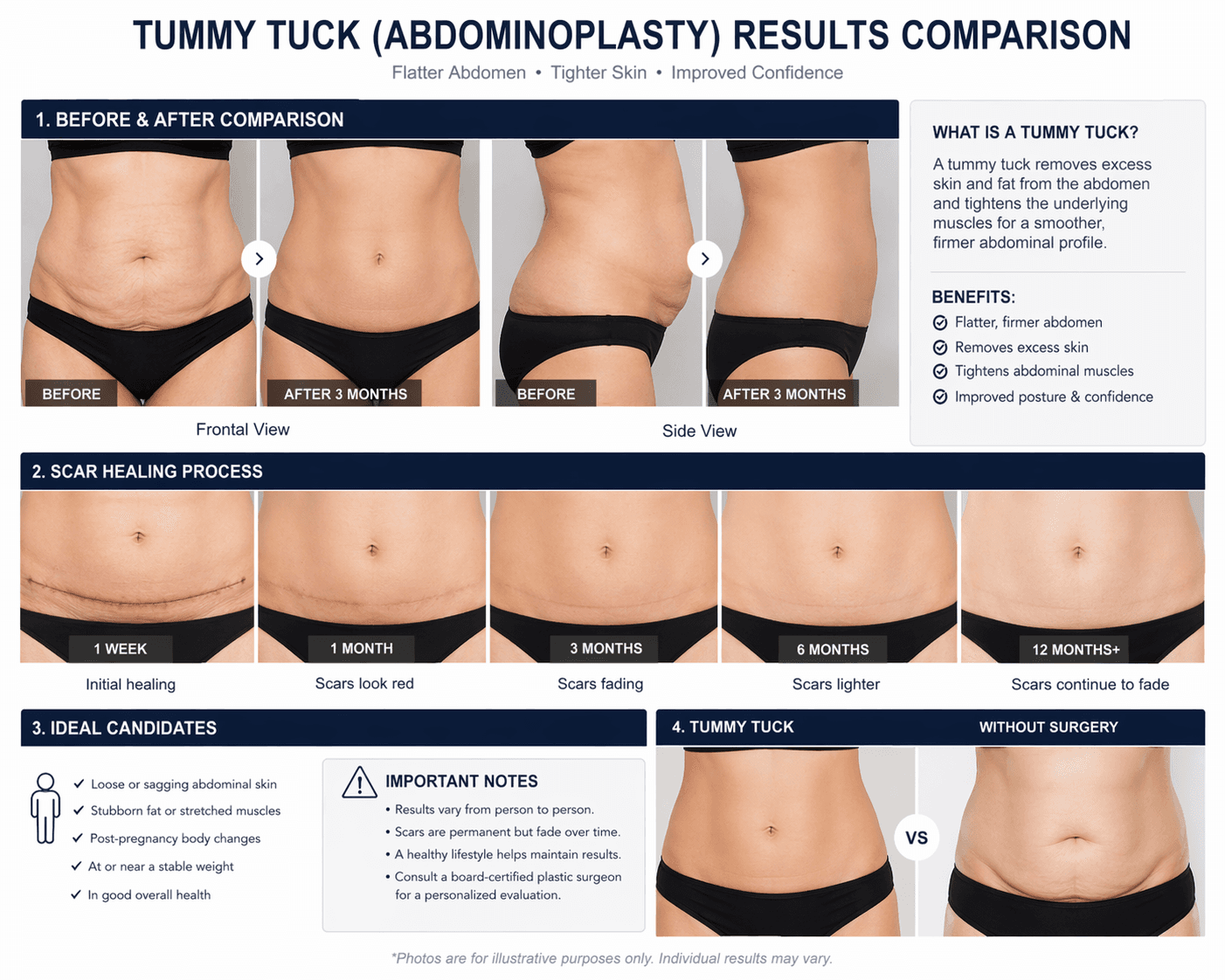 Tummy Tuck & Pembentukan Tubuh
